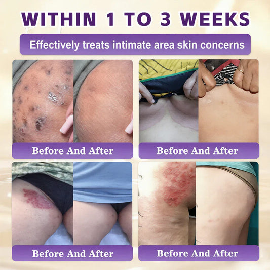 Windolixยฎ Biotin 10-in-1 Skin Restoration Cream
