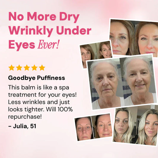 Revive Tired Eyes โ Hydrating & Anti-Wrinkle Eye Balm