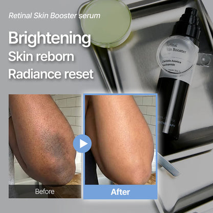 MEDITHERAPY Retinal Skin Booster Serum | Retinaldehyde, Niacinamide Anti-Aging Serum - K-Beauty Facial Serum for Fine Lines, Firming & Radiance | Hydrating Face Serum All Skin Types