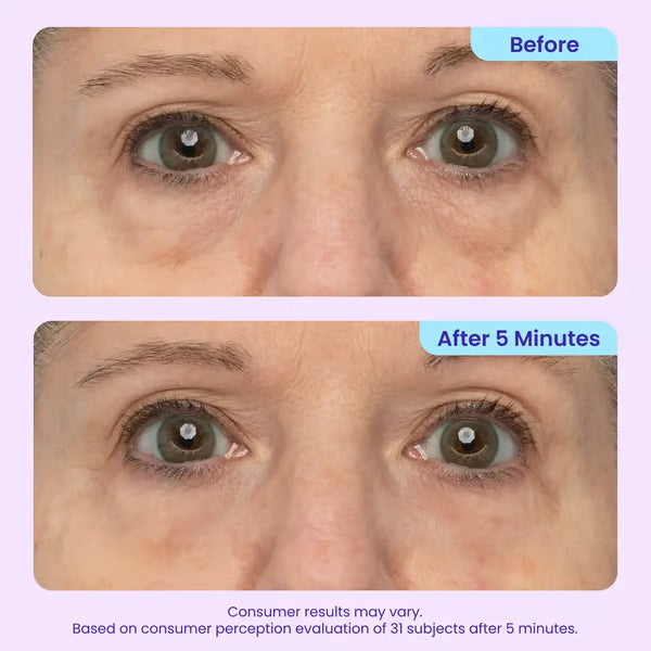 🔥2026 NEW! Instant Firming Eye Gel – Lift, Smooth & De-Puff in Minutes