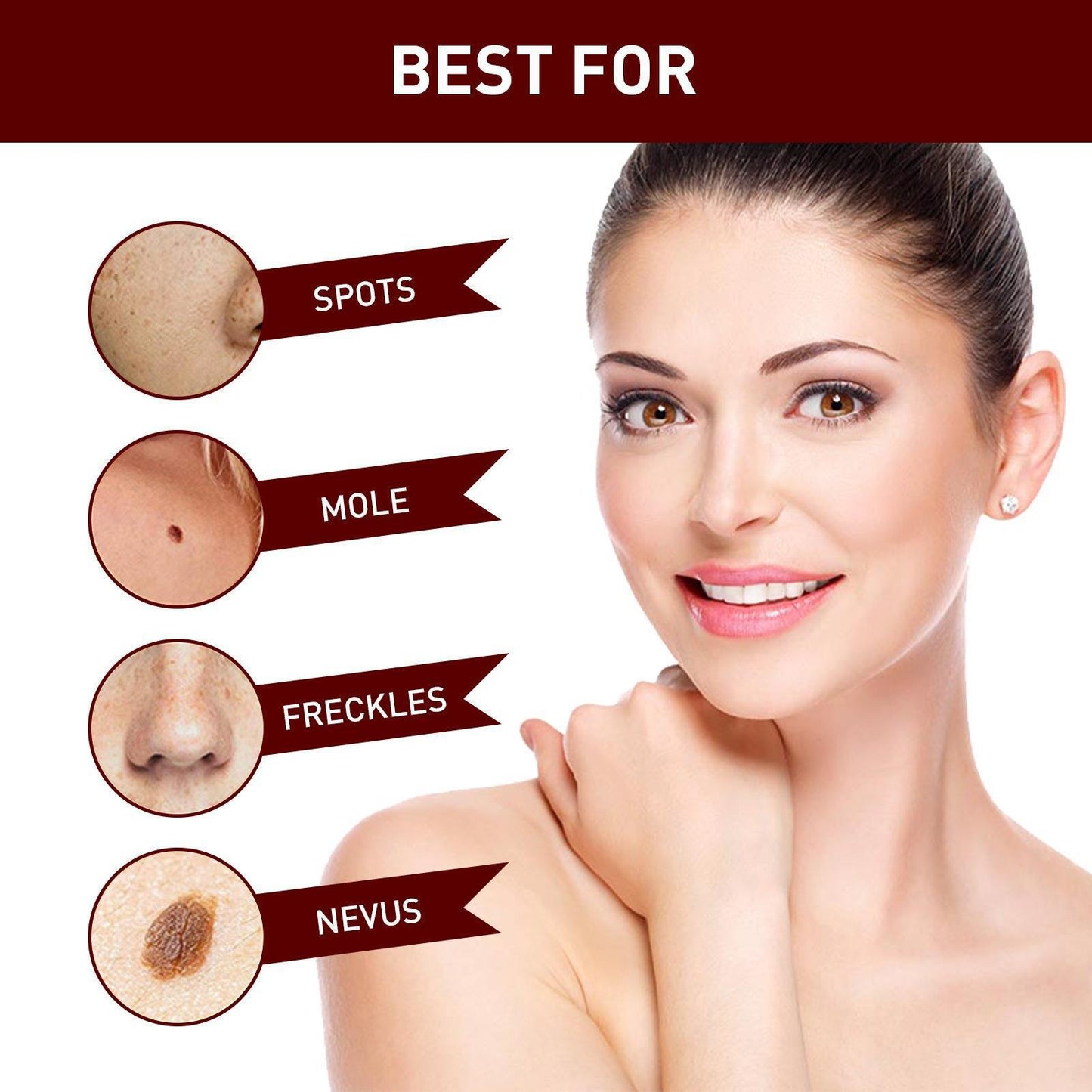 Fivfivgo WipeOff Tags & Mole Remover