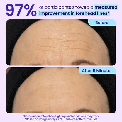 🔥2026 NEW! Instant Firming Eye Gel – Lift, Smooth & De-Puff in Minutes