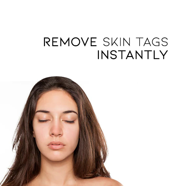 Fivfivgo WipeOff Tags & Mole Remover