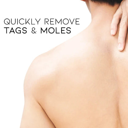 Fivfivgo WipeOff Tags & Mole Remover