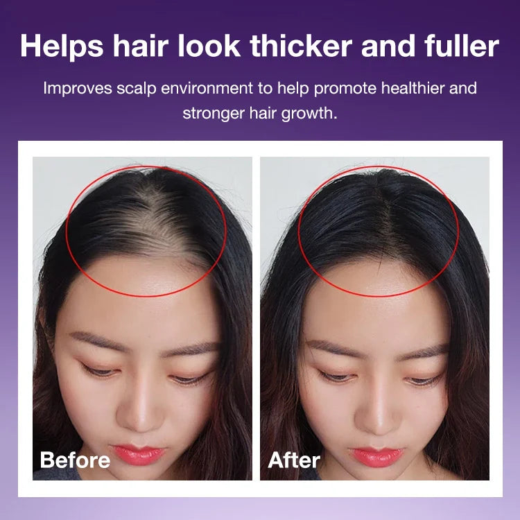 Hair Thickening Roll-On Serum Reduces Hair Shedding / Targets Thinning Areas / Nourishes the Scalp Support fuller, healthier-looking hair every day