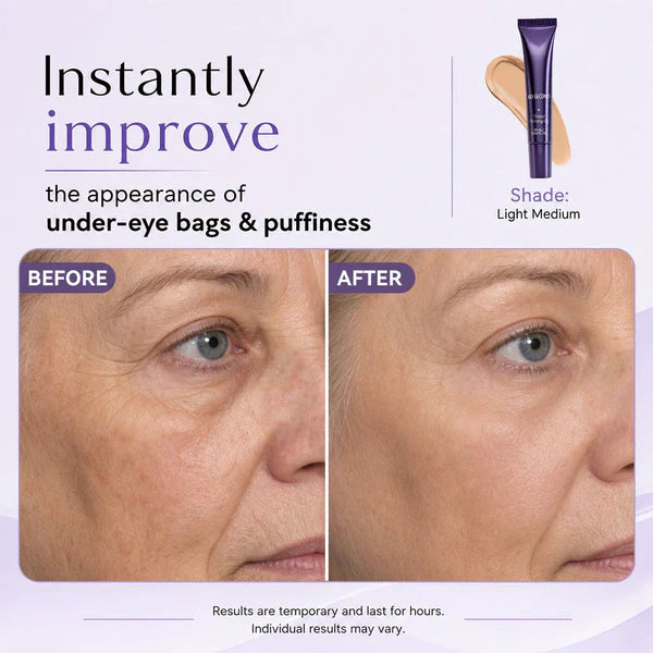 Effects👁️✨⏱️Eye Effects-Reduce the Appearance of Puffiness, Fine Lines, Wrinkles, and Under-Eye Circles
