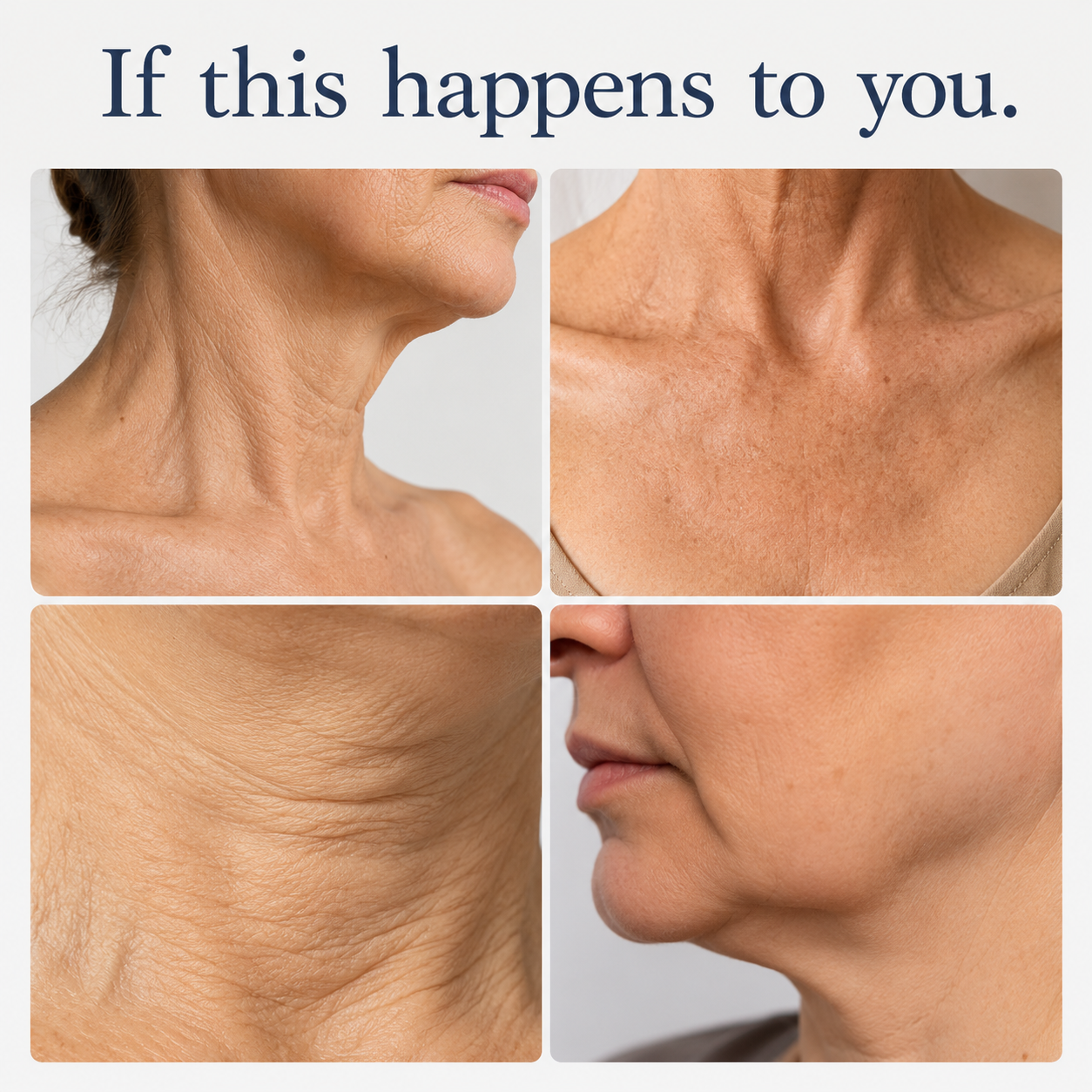 ✨ CAFFEINE MATRIXBUST FIRMING NECK CREAM