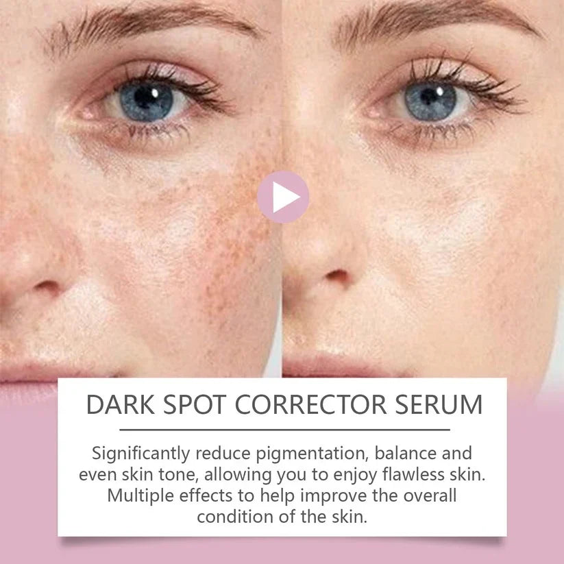 🔥Limited Time Offer🔥Advanced Dark Spot Corrector Serum -Multi-Correction Brightening Formulafor Sun Spots, Age Spots, and Melasma