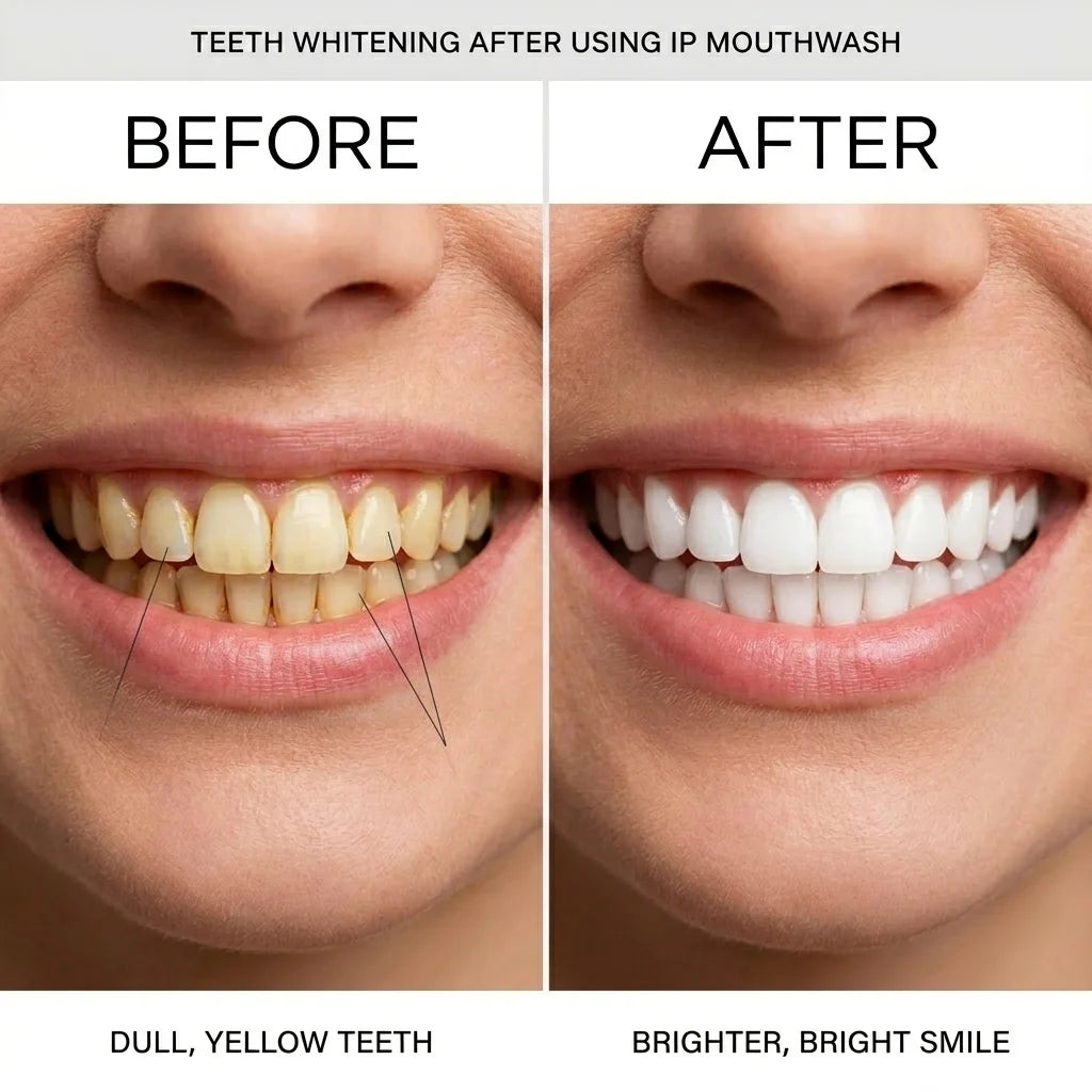 😁 Teeth whitening, gum swelling and pain relief, gum repair, halitosis treatment, mouthwash for removing foreign objects, whitening mouthwash