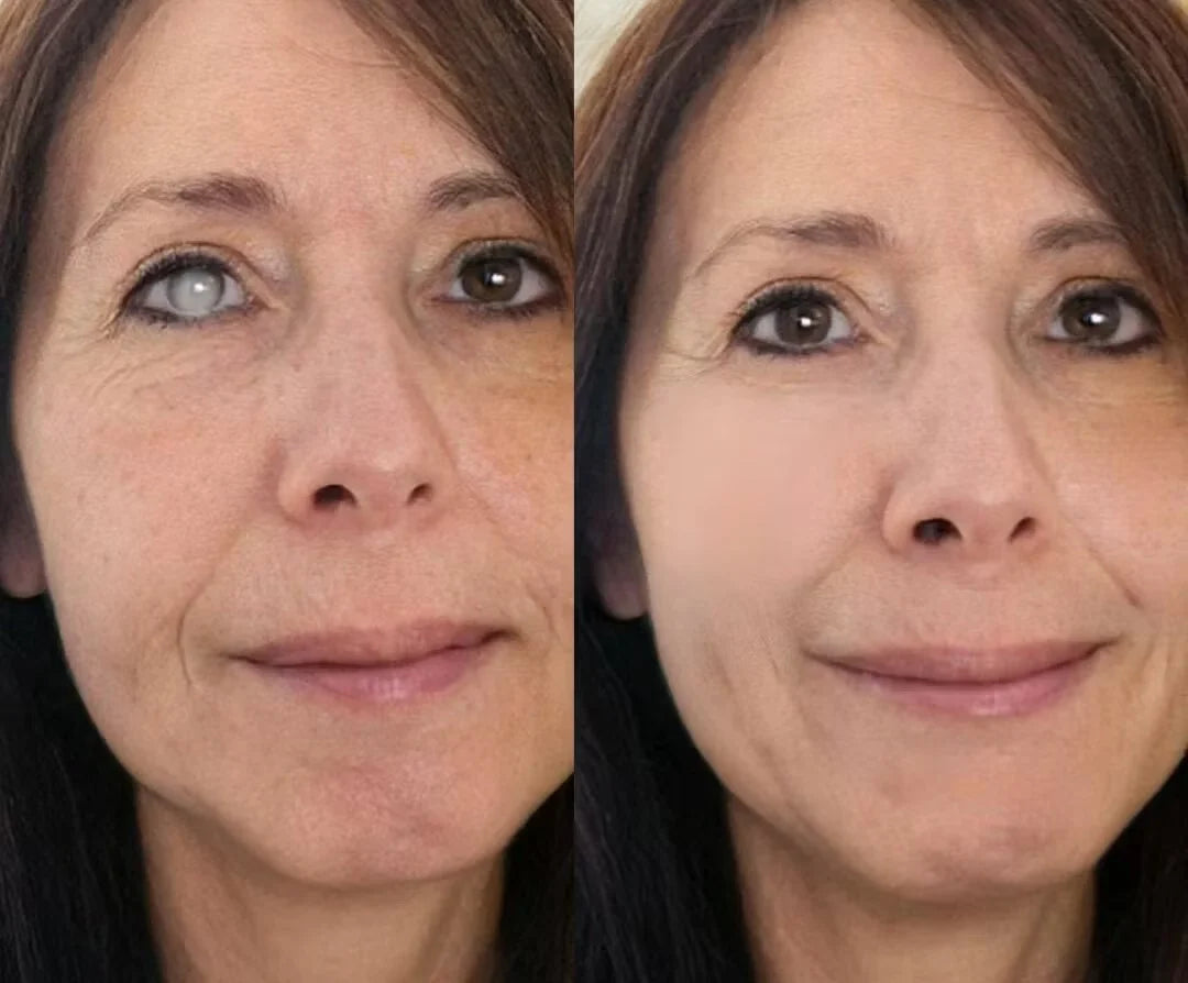 👁️ NANO EYE ROLLER SERUM