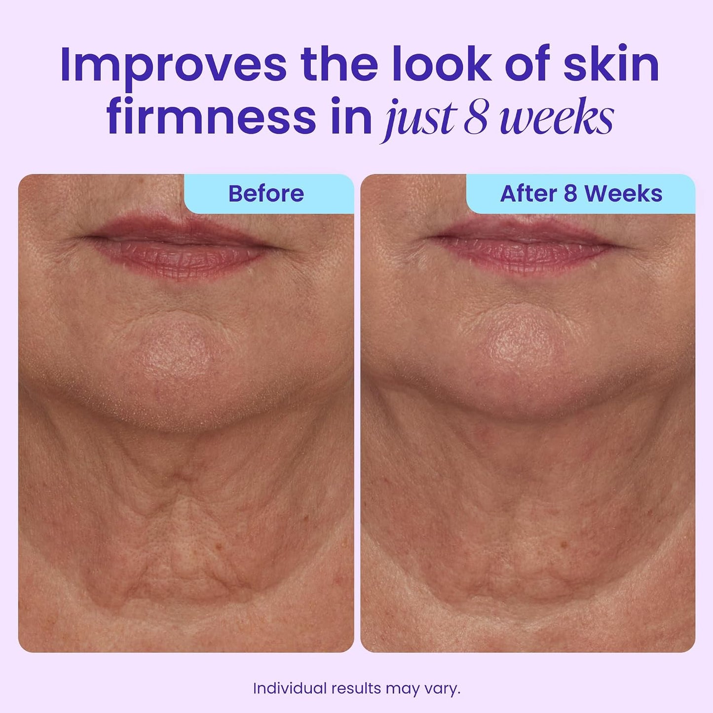 ✨ CAFFEINE MATRIXBUST FIRMING NECK CREAM
