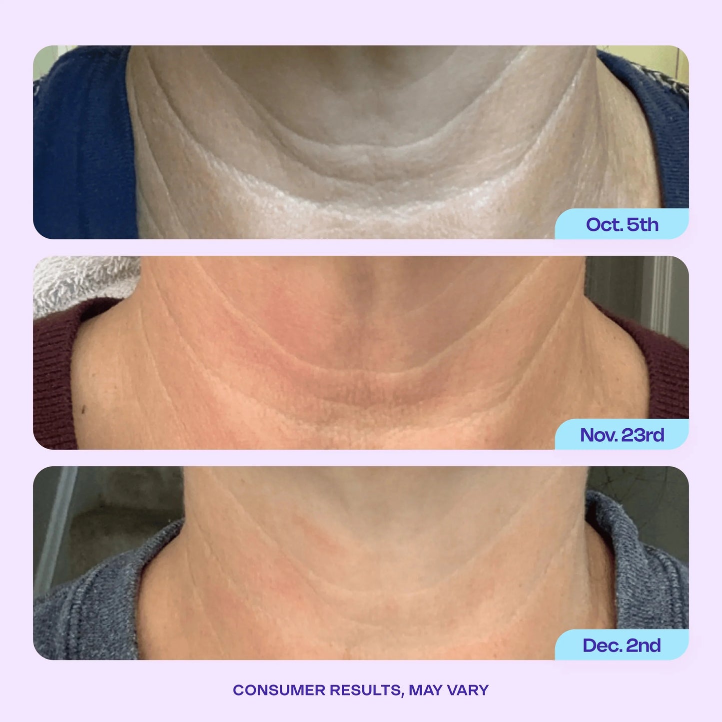 ✨ CAFFEINE MATRIXBUST FIRMING NECK CREAM