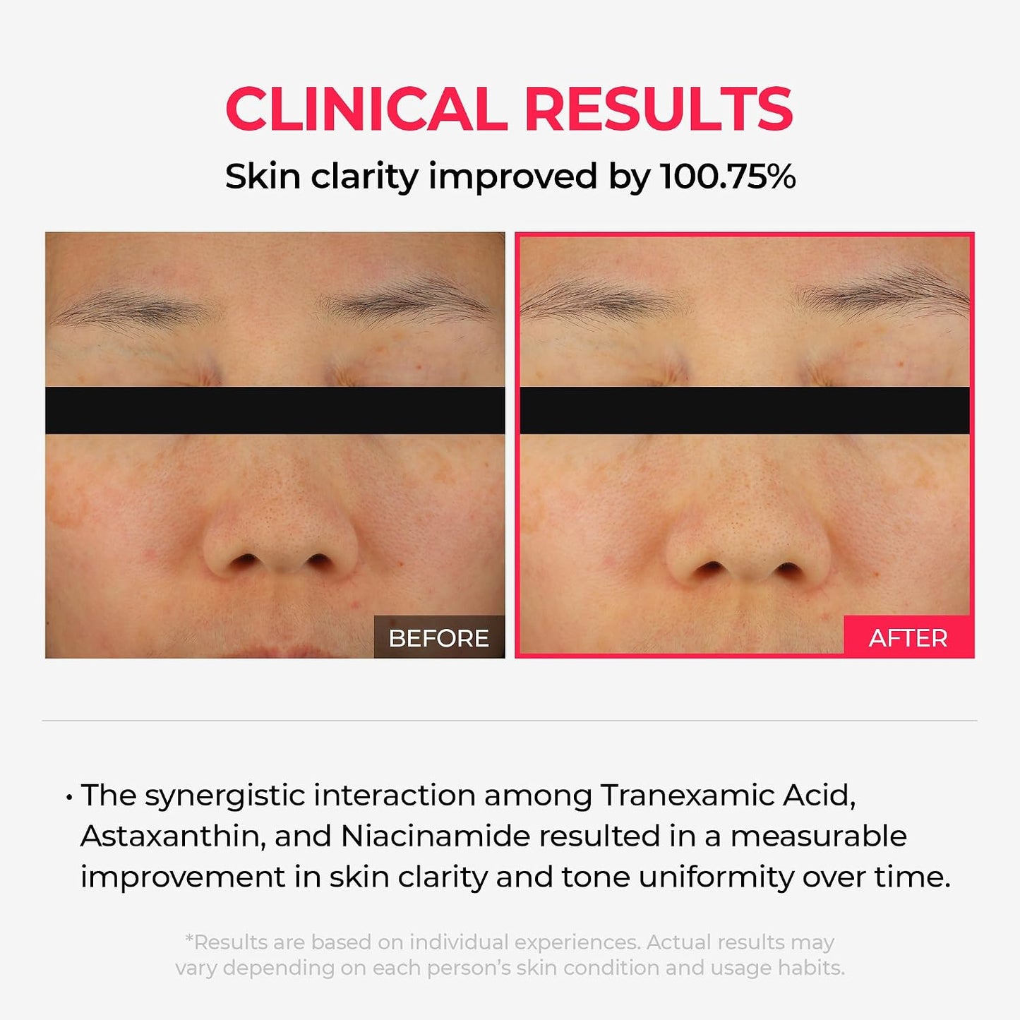 💛 ✨Korean TX Astaxanthin Overnight Peel-Off Mask
