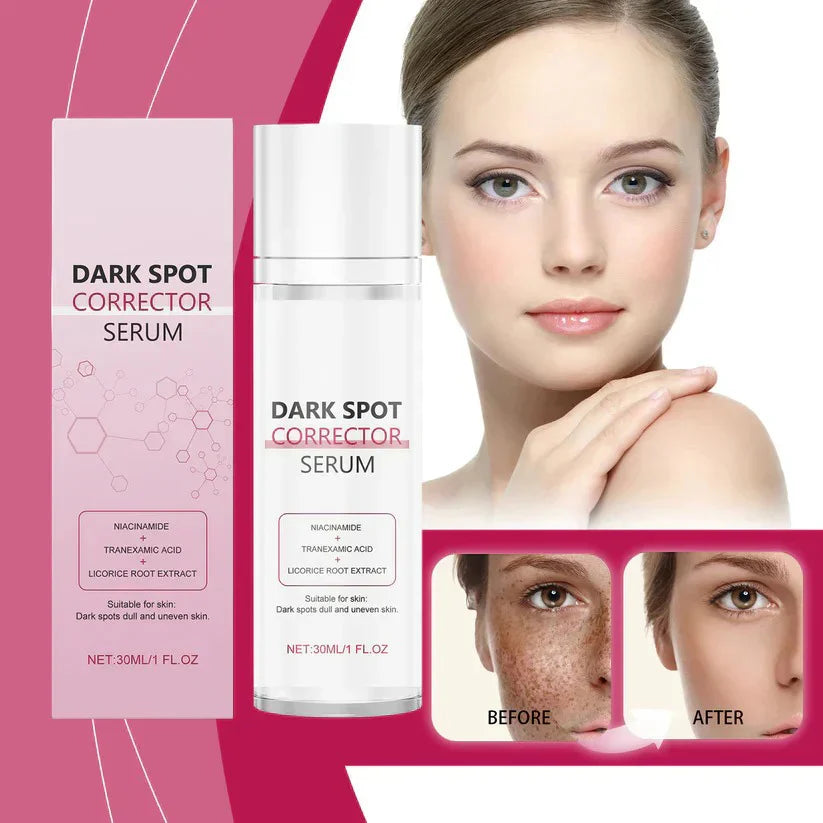 🔥Limited Time Offer🔥Advanced Dark Spot Corrector Serum -Multi-Correction Brightening Formulafor Sun Spots, Age Spots, and Melasma