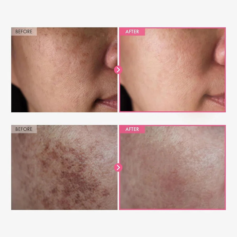 💛 ✨Korean TX Astaxanthin Overnight Peel-Off Mask