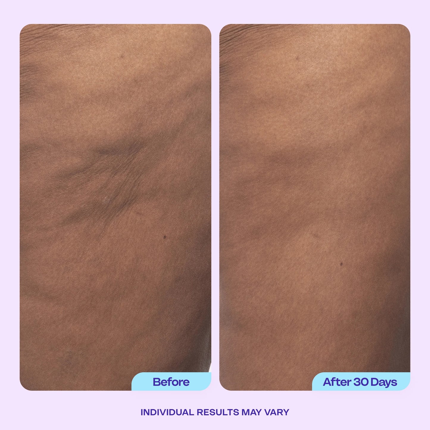 ✨ CAFFEINE MATRIXBUST FIRMING NECK CREAM
