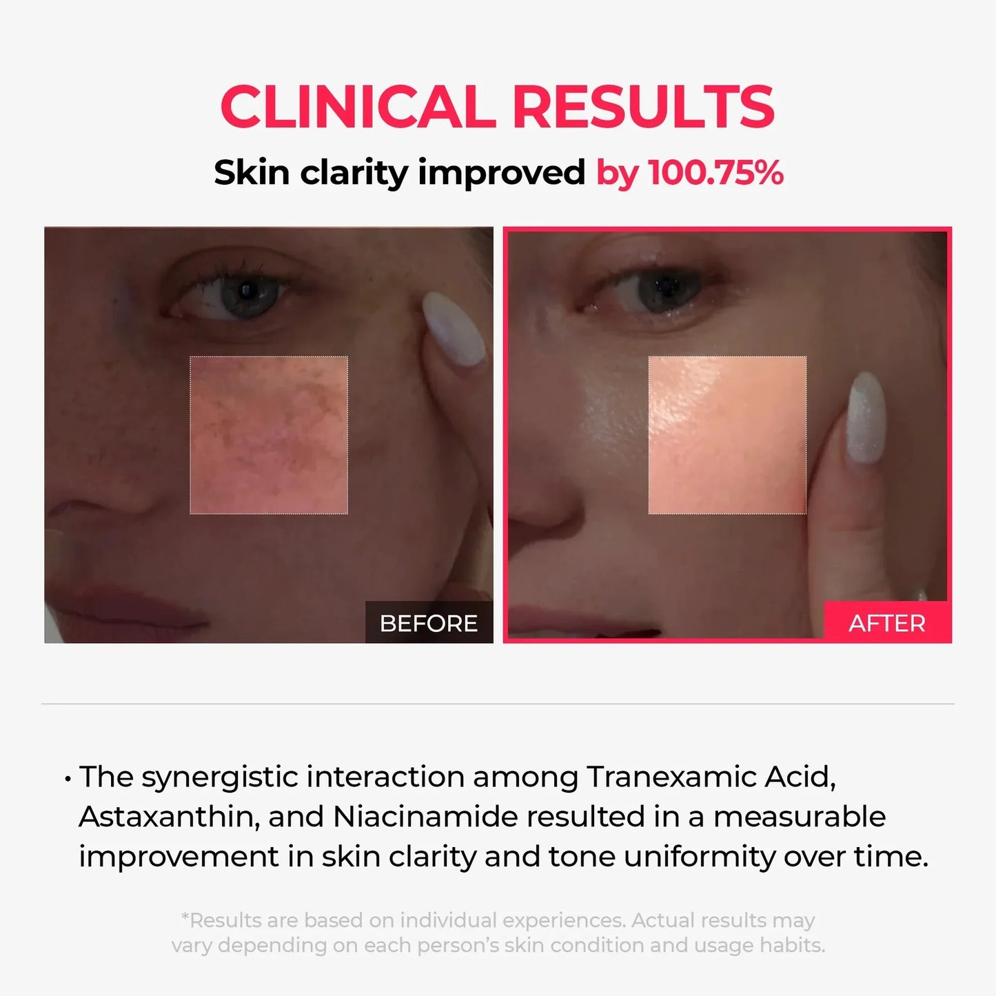 💛 ✨Korean TX Astaxanthin Overnight Peel-Off Mask